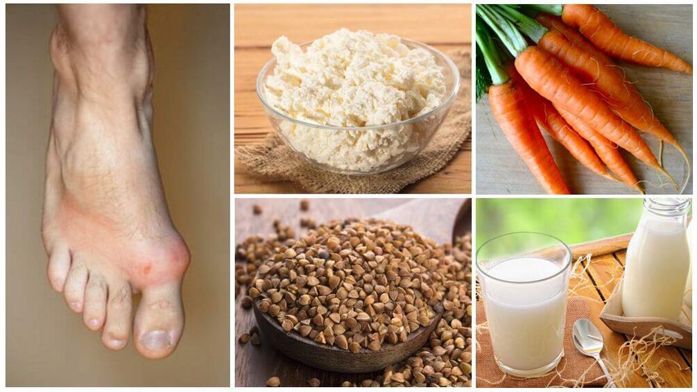 food for gout